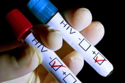 Industria porno a fost paralizata de un nou caz de contaminare cu HIV. "Sanatatea e prima grija" Industria porno a fost paralizata de un nou caz de contaminare cu HIV. "Sanatatea e prima grija"