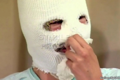 Mutilata pentru ca era prea frumoasa. O studenta a fost atacata cu acid de o prietena geloasa Mutilata pentru ca era prea frumoasa. O studenta a fost atacata cu acid de o prietena geloasa