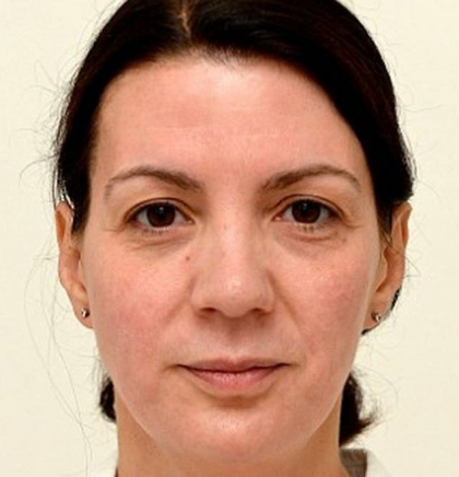 Cum a ajuns sa arate femeia asta dupa ce a baut cate 3 litri de apa pe zi! "Nu credeam ca e posibil" - FOTO Cum a ajuns sa arate femeia asta dupa ce a baut cate 3 litri de apa pe zi! "Nu credeam ca e posibil" - FOTO