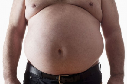 Imagini socante! Cum a ajuns sa arate dupa ce a slabit 72 de kilograme - VIDEO Imagini socante! Cum a ajuns sa arate dupa ce a slabit 72 de kilograme - VIDEO