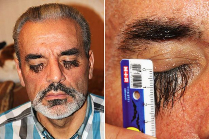 A mancat un aliment-minune si i-au crescut excesiv genele. Barbatul vrea acum sa intre in Cartea Recordurilor