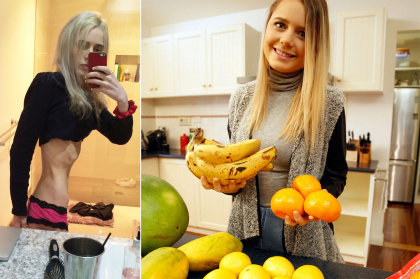N-a mancat si n-a baut nimic o saptamana ca sa devina vedeta liceului. Cum arata adolescenta la 33 de kilograme