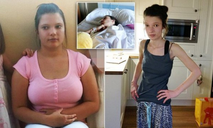 A ajuns sa cantareasca doar 25 de kilograme! Transformarea unei tinere i-a uimit pe toti - FOTO A ajuns sa cantareasca doar 25 de kilograme! Transformarea unei tinere i-a uimit pe toti - FOTO