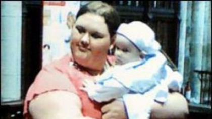 De la 215 kg la 44 kg. In urma cu sase ani era cea mai grasa adolescenta, iar acum a ajuns anorexica - FOTO