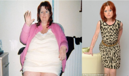 Si-a dorit toata viata sa slabeasca, dar acum regreta. De ce vrea sa aiba din nou 120 de kilograme Si-a dorit toata viata sa slabeasca, dar acum regreta. De ce vrea sa aiba din nou 120 de kilograme
