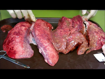 Imagini explicite! Ce se intampla cu plamanii tai in timp ce fumezi! In ce hal pot sa arate dupa doar 60 de tigari - VIDEO