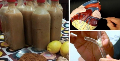 Doua linguri luate din acest preparat in fiecare dimineata te ajuta sa previi intarirea arterelor Doua linguri luate din acest preparat in fiecare dimineata te ajuta sa previi intarirea arterelor