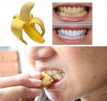 Secretul la indemana oricui, ce are rezultate spectaculoase! Cum iti albesti dintii imediat cu o coaja de banana Secretul la indemana oricui, ce are rezultate spectaculoase! Cum iti albesti dintii imediat cu o coaja de banana