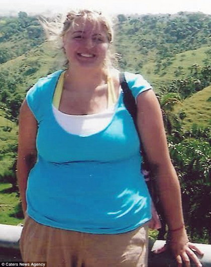 A slabit 60 de kilograme în 21 de zile si e mandra sa-si arate corpul plin de vergeturi. "Vergeturile sunt o dovada ca am ajuns atat de departe" A slabit 60 de kilograme în 21 de zile si e mandra sa-si arate corpul plin de vergeturi. "Vergeturile sunt o dovada ca am ajuns atat de departe"