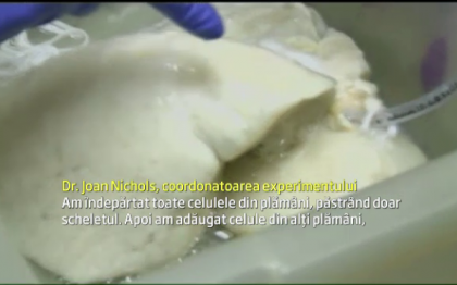 Experiment revolutionar in SUA. Metoda prin care cercetatorii au reusit sa "cultive" in laborator prima pereche de plamani Experiment revolutionar in SUA. Metoda prin care cercetatorii au reusit sa "cultive" in laborator prima pereche de plamani