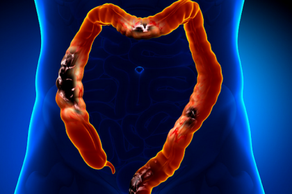 Ce se intampla in organismul tau atunci cand mananci carne! Incredibil ce au constatat specialistiii Ce se intampla in organismul tau atunci cand mananci carne! Incredibil ce au constatat specialistiii