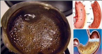 Efectul teribil pe care il are cafeaua bauta pe stomacul gol! Te distruge Efectul teribil pe care il are cafeaua bauta pe stomacul gol! Te distruge