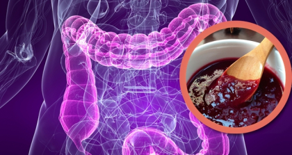 Cel mai bun laxativ natural! Consuma acest aliment pentru golirea intestinelor de toxine si surplusuri de lichid