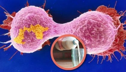 Bautura care produce cancer la san, o consumi aproape zilnic, nestiind ca este atat de periculoasa Bautura care produce cancer la san, o consumi aproape zilnic, nestiind ca este atat de periculoasa