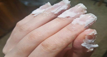 Freaca-ti unghiile cu bicarbonat de sodiu si vezi ce sa intampla. Este uimitor Freaca-ti unghiile cu bicarbonat de sodiu si vezi ce sa intampla. Este uimitor