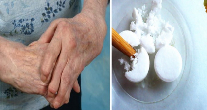 Acesta este preparatul din 3 ingrediente, care iti intinereste oasele cu 20 de ani! Iata cum se prepara Acesta este preparatul din 3 ingrediente, care iti intinereste oasele cu 20 de ani! Iata cum se prepara