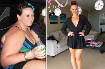 De la obezitate morbida, la trup de TOP MODEL! Vezi cum a reusit aceasta tanara sa slabeasca, fara interventii chirurgicale De la obezitate morbida, la trup de TOP MODEL! Vezi cum a reusit aceasta tanara sa slabeasca, fara interventii chirurgicale
