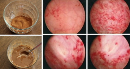 Se spune ca aceasta combinatie este buna pentru organism, insa iata ce iti poate face Se spune ca aceasta combinatie este buna pentru organism, insa iata ce iti poate face