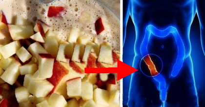 Amestecul MINUNE din 5 ingrediente care iti curata colonul de toxine Amestecul MINUNE din 5 ingrediente care iti curata colonul de toxine