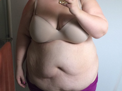 Femeia asta obeza poarta un costum de baie pentru prima data in viata! A slabit 100 de kilograme! Trebuie sa vezi cum arata acum! Femeia asta obeza poarta un costum de baie pentru prima data in viata! A slabit 100 de kilograme! Trebuie sa vezi cum arata acum!
