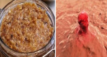 O femeie in varsta de 56 de ani, a descoperit reteta tratamentului pentru cancerul ovarian, alcatuita din doar trei ingrediente O femeie in varsta de 56 de ani, a descoperit reteta tratamentului pentru cancerul ovarian, alcatuita din doar trei ingrediente
