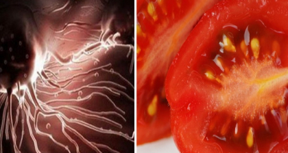 Aceste 7 alimente distrug celulele de cancer! De ce ar trebui sa le incluzi in alimentatia ta zilnica