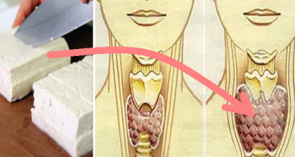 Ei il numesc alimentul sanatos, insa poate distruge cu usurinta tiroida si celulele creierului Ei il numesc alimentul sanatos, insa poate distruge cu usurinta tiroida si celulele creierului