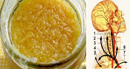 Remediul german care vindeca orice infectie din corp, coboara colesterolul si intareste imunitatea Remediul german care vindeca orice infectie din corp, coboara colesterolul si intareste imunitatea