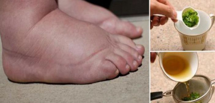 Picioare umflate si circulatie proasta? Consuma acest amestec in fiecare zi