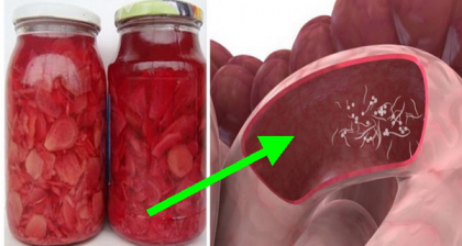 Preparat astfel, ghimbirul elimina parazitii din intestine, scade colesterolul si vindeca simptomele de artrita