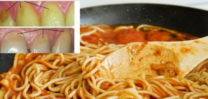 Aceste alimente iti ataca dintii! Afla de ce trebuie sa te feresti Aceste alimente iti ataca dintii! Afla de ce trebuie sa te feresti