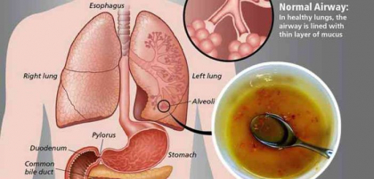 Fiecare inghititura din acest ceai facut din trei ingrediente iti curata plamanii de mucus, toxine si inflamatii Fiecare inghititura din acest ceai facut din trei ingrediente iti curata plamanii de mucus, toxine si inflamatii