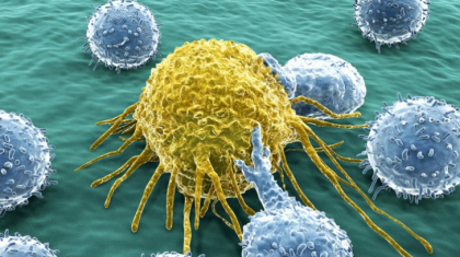 Semnele care iti arata ca poti face cancer. Cum sa-l eviti Semnele care iti arata ca poti face cancer. Cum sa-l eviti