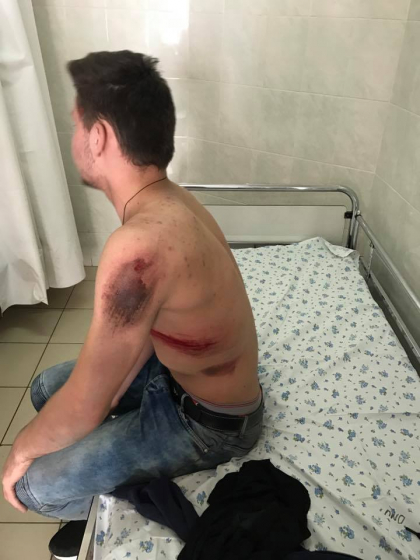 O soferita din capitala a lovit un tanar pe o trecere de pietoni si s-a facut nevazuta: a fost gasita dupa ce i-au cazut placutele de la masina chiar pe zebra. Ce s-a intamplat cu victima - FOTO O soferita din capitala a lovit un tanar pe o trecere de pietoni si s-a facut nevazuta: a fost gasita dupa ce i-au cazut placutele de la masina chiar pe zebra. Ce s-a intamplat cu victima - FOTO