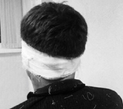 O tanara de 18 ani din capitala si-a injunghiat parintii. Pe tatal sau l-a ranit la picior, iar pe mama - la cap. Fiica lor are dereglari psihice, spune politia. Parintii se afla la spital