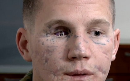 Un soldat american, care s-a aruncat pe o grenada pentru a-si salva prietenul, ar putea primi Medalia de Onoare Un soldat american, care s-a aruncat pe o grenada pentru a-si salva prietenul, ar putea primi Medalia de Onoare
