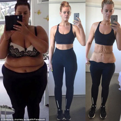 Transformarea uluitoare a unei tinere care a slabit 92 de kilograme! Dieta-minune a devenit virala Transformarea uluitoare a unei tinere care a slabit 92 de kilograme! Dieta-minune a devenit virala