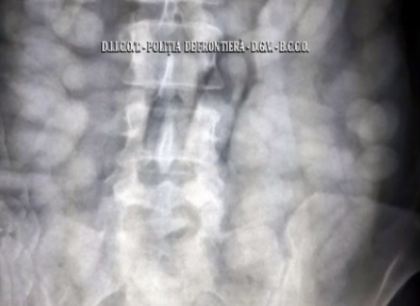 Doi brazilieni, retinuti pe Aeroportul Otopeni din Romania. Cata cocaina aveau in stomac Doi brazilieni, retinuti pe Aeroportul Otopeni din Romania. Cata cocaina aveau in stomac
