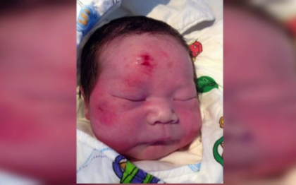 "Copilul miracol" a venit pe lume in timp ce mama sa murea intr-un accident rutier "Copilul miracol" a venit pe lume in timp ce mama sa murea intr-un accident rutier