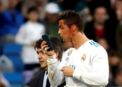 Glume pe seama lui Cristiano Ronaldo dupa ce si-a verificat rana de la cap cu telefonul - FOTO Glume pe seama lui Cristiano Ronaldo dupa ce si-a verificat rana de la cap cu telefonul - FOTO