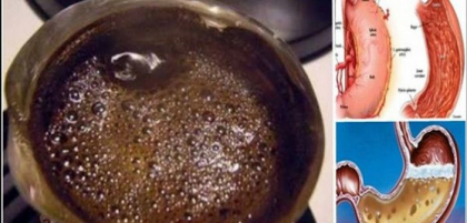 Bei cafea pe stomacul gol dimineata? Nu mai comite niciodata aceasta greseala Bei cafea pe stomacul gol dimineata? Nu mai comite niciodata aceasta greseala