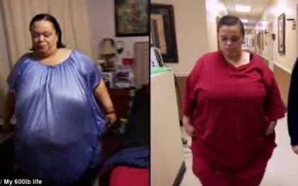 Cum a reusit o femeie sa slabeasca 127 de kilograme intr-un an. Stomacul ei are acum dimensiunile unui ou