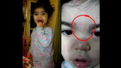 Si-a luat copilul de la cresa cu o iritatie pe frunte. Acasa, mama si-a dat seama de la ce era pata si a avut un soc Si-a luat copilul de la cresa cu o iritatie pe frunte. Acasa, mama si-a dat seama de la ce era pata si a avut un soc