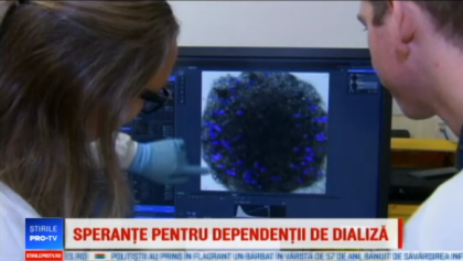 Cercetatorii ar putea crea rinichi artificiali din celule stem, eliminand dializa
