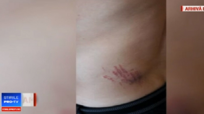 Un politist roman, atacat cu toporul dupa ce i-a luat apararea sotiei Un politist roman, atacat cu toporul dupa ce i-a luat apararea sotiei