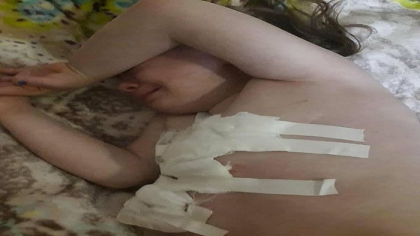 Fiecare zi e o noua lupta. Povestea Anastasiei, o fetita de sase ani, din Drochia, care lupta cu o boala grea: " Mamica si Nastica au nevoie de noi". Cum poti sa o ajuti sa traiasca - FOTO