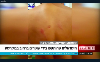 Turisti israelieni, batuti la mitingul de vineri, din Bucuresti. Reactia Ambasadei Israelului - VIDEO Turisti israelieni, batuti la mitingul de vineri, din Bucuresti. Reactia Ambasadei Israelului - VIDEO