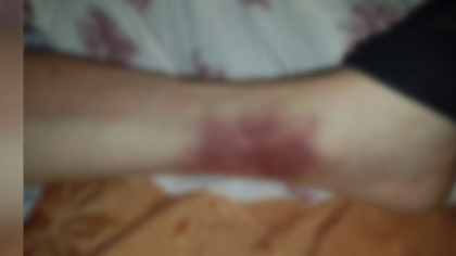 Pacient legat de maini si picioare de patul din salon, intr-un spital din Iasi. Acuzatiile familiei Pacient legat de maini si picioare de patul din salon, intr-un spital din Iasi. Acuzatiile familiei