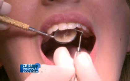 Fumatul poate duce la distrugerea lucrarilor dentare. Ce recomanda stomatologii Fumatul poate duce la distrugerea lucrarilor dentare. Ce recomanda stomatologii
