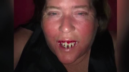 Imagini care pot afecta emotional. O femeie din Alabama si-a lipit dinti de zombie de Halloween, dar dupa petrecere a avut un soc: "Nu mai fac niciodata" - FOTO/VIDEO